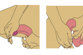 flexion of the penis to increase